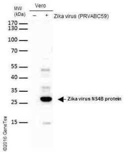 Zika virus NS4B Antibody, Novus Biologicals 100 &mu;g | Buy Online | Novus Biologicals | Fisher Scientific