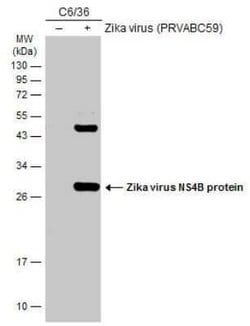 Zika virus NS4B Antibody, Novus Biologicals 100 &mu;g | Buy Online | Novus Biologicals | Fisher Scientific