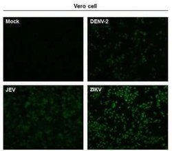 Zika virus NS5 Antibody, Novus Biologicals 100 &mu;g | Buy Online | Novus Biologicals | Fisher Scientific