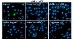 Zika virus NS5 Antibody, Novus Biologicals 100 &mu;g | Buy Online | Novus Biologicals | Fisher Scientific