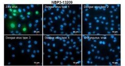 Zika virus NS5 Antibody, Novus Biologicals 100 &mu;g | Buy Online | Novus Biologicals | Fisher Scientific