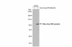 Zika virus NS5 Antibody, Novus Biologicals 100 &mu;g | Buy Online | Novus Biologicals | Fisher Scientific