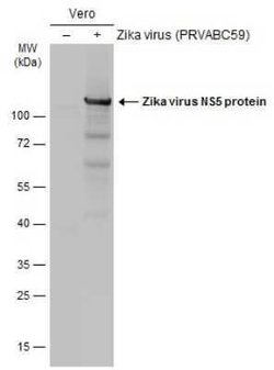 Zika virus NS5 Antibody, Novus Biologicals 100 &mu;g | Buy Online | Novus Biologicals | Fisher Scientific