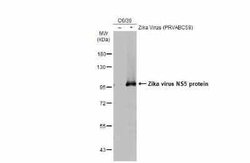 Zika virus NS5 Antibody, Novus Biologicals 100 &mu;g | Buy Online | Novus Biologicals | Fisher Scientific