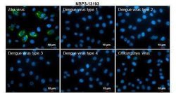 Zika virus prM Antibody, Novus Biologicals 100 &mu;g | Buy Online | Novus Biologicals | Fisher Scientific