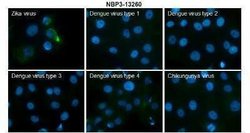 Zika virus prM Antibody, Novus Biologicals 100 &mu;g; Unconjugated:Antibodies,