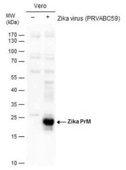 Zika virus prM Antibody, Novus Biologicals 100 &mu;g | Buy Online | Novus Biologicals | Fisher Scientific
