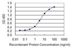 Zinc finger protein 287 Antibody (3A2), Novus Biologicals 0.1 mg; Unconjugated:Antibodies,
