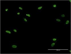 Zinc finger protein 287 Antibody (3E12), Novus Biologicals 0.1 mg; Unconjugated:Antibodies,