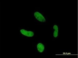 Zinc finger protein 287 Antibody, Novus Biologicals 0.05 mg; Unconjugated:Antibodies,