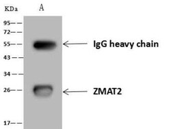 Zmat2 Antibody, Novus Biologicals:Antibodies:Primary Antibodies