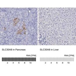 ZnT-8/SLC30A8 Antibody, Novus Biologicals 25ul; Unconjugated:Antibodies,
