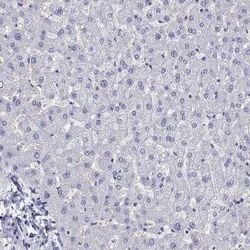 ZnT-8/SLC30A8 Antibody, Novus Biologicals 25ul; Unconjugated:Antibodies,
