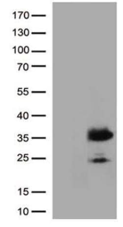 ZsGreen1 Antibody (OTI3C4), Novus Biologicals 100 uL, Unconjugated:Antibodies,