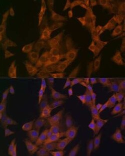 Zyxin Rabbit anti-Human, Mouse, Clone: 4F9P3, Novus Biologicals 20 &mu;g;