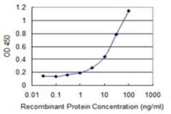 Zyxin Antibody (2D1), Novus Biologicals 0.1 mg, Unconjugated:Antibodies,