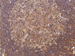 actin-related protein 2/3 complex subunit 1B Antibody, Novus Biologicals