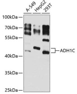 alcohol dehydrogenase 1C Antibody - BSA Free, Novus Biologicals 0.1 mL,