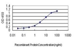 alcohol dehydrogenase 4 Antibody (3C5), Novus Biologicals 0.1 mg | Buy Online | Novus Biologicals | Fisher Scientific