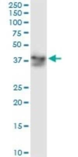 alcohol dehydrogenase 5 Antibody (12F7), Novus Biologicals 0.1 mg | Buy Online | Novus Biologicals | Fisher Scientific