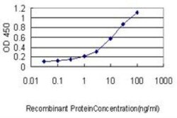 Novus Biologicals alpha 1-Acid Glycoprotein Antibody (2F9-1F10), Novus Biologicals 0.1 mg | Buy Online | Novus Biologicals&trade; | Fisher Scientific