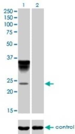 Novus Biologicals alpha 1-Acid Glycoprotein Antibody (2F9-1F10), Novus Biologicals 0.1 mg | Buy Online | Novus Biologicals&trade; | Fisher Scientific