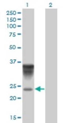 Novus Biologicals alpha 1-Acid Glycoprotein Antibody (2F9-1F10), Novus Biologicals 0.1 mg | Buy Online | Novus Biologicals&trade; | Fisher Scientific