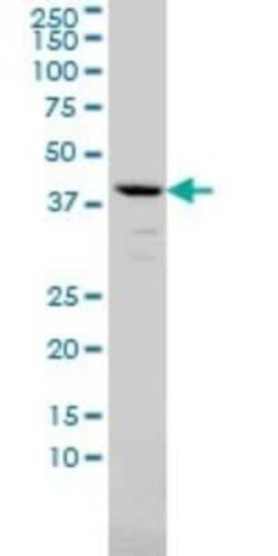 alpha 1-Microglobulin Antibody (3F1), Novus Biologicals 0.1 mg | Buy Online | Novus Biologicals | Fisher Scientific