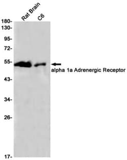 alpha-1A Adrenergic R/ADRA1A Antibody (S04-8B8), Novus Biologicals:Antibodies:Primary