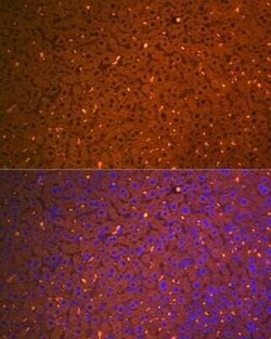 alpha 2-Macroglobulin Rabbit anti-Human, Mouse, Rat, Clone: 7V6M10, Novus Biologicals 100 &mu;g | Buy Online | Novus Biologicals | Fisher Scientific