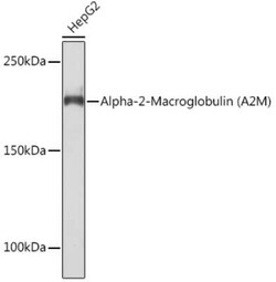 alpha 2-Macroglobulin Rabbit anti-Human, Mouse, Rat, Clone: 7V6M10, Novus Biologicals 100 &mu;g | Buy Online | Novus Biologicals | Fisher Scientific