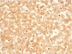 alpha 2-Macroglobulin Antibody (A2M/3621) - Azide and BSA Free, Novus Biologicals 100 &mu;g | Buy Online | Novus Biologicals | Fisher Scientific