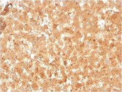 alpha 2-Macroglobulin Antibody (A2M/3623) - Azide and BSA Free, Novus Biologicals