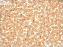 alpha 2-Macroglobulin Antibody (A2M/3623) - Azide and BSA Free, Novus Biologicals