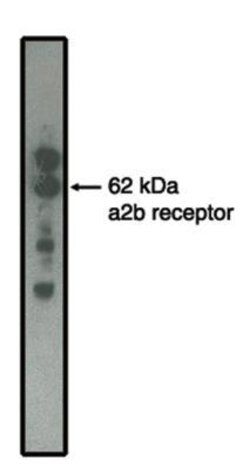 alpha-2B Adrenergic R/ADRA2B Antibody (5G10), Novus Biologicals 100&mu;g:Antibodies,