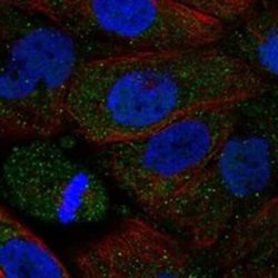 alpha-2B Adrenergic R/ADRA2B Rabbit anti-Human, Polyclonal, Novus Biologicals:Antibodies:Primary
