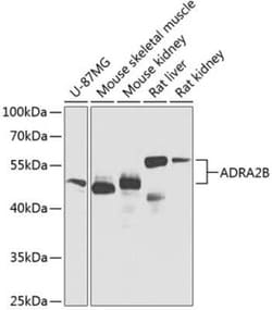 alpha-2B Adrenergic R/ADRA2B Antibody - BSA Free, Novus Biologicals 0.02