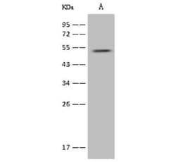 alpha-2B Adrenergic R/ADRA2B Antibody, Novus Biologicals 100 &mu;g, Unconjugated:Antibodies,