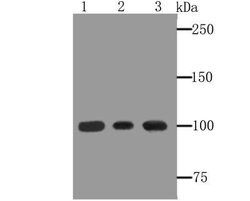 alpha-Actinin 1 Rabbit anti-Human, Mouse, Rat, Polyclonal, Novus Biologicals
