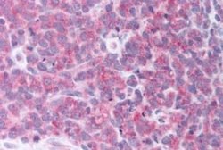 alpha-Aminoadipate Aminotransferase Antibody, Novus Biologicals 50 &mu;g;