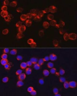 alpha-Defensin 1 Antibody - Azide and BSA Free, Novus Biologicals 100 &mu;g;