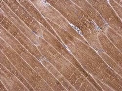 alpha Desmuslin Antibody, Novus Biologicals 100 μg; Unconjugated:Antibodies,