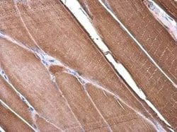 alpha Desmuslin Antibody, Novus Biologicals 100 μg; Unconjugated:Antibodies,