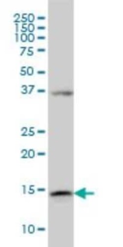 alpha Endosulfine Antibody (1H7), Novus Biologicals 0.1 mg | Buy Online | Novus Biologicals | Fisher Scientific
