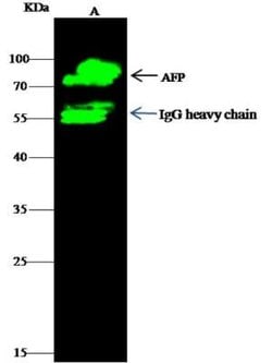 alpha-Fetoprotein/AFP Rabbit anti-Human, Clone: 3, Novus Biologicals:Antibodies:Primary