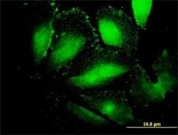 alpha-Fetoprotein/AFP Antibody (1G7), Novus Biologicals 0.1 mg | Buy Online | Novus Biologicals | Fisher Scientific