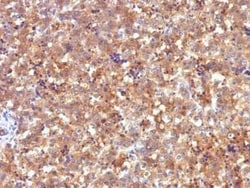 alpha-Fetoprotein/AFP Antibody (C2), Novus Biologicals 0.1mg; Unlabeled:Antibodies,
