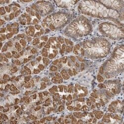 alpha-Fetoprotein/AFP Antibody, Novus Biologicals 0.1 mL; Unconjugated:Antibodies,