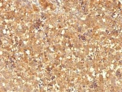 alpha-Fetoprotein/AFP Antibody (MBS-12), Novus Biologicals 0.02mg; Unlabeled:Antibodies,