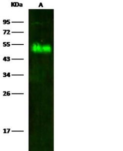 alpha-Galactosidase A/GLA Rabbit anti-Human, Clone: 1, Novus Biologicals